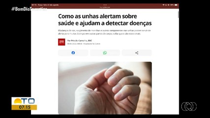Dermatologista fala sobre saúde das unhas no Bom Dia Responde
