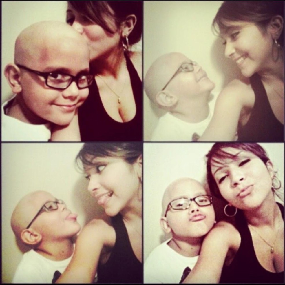 Luís Adolpho durante tratamento oncológico na infância — Foto: Arquivo Pessoal