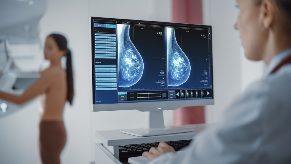 Mamografia: médicos desmistificam fake news sobre radiação de exame que pode salvar vidas — Foto: Adobe Stock