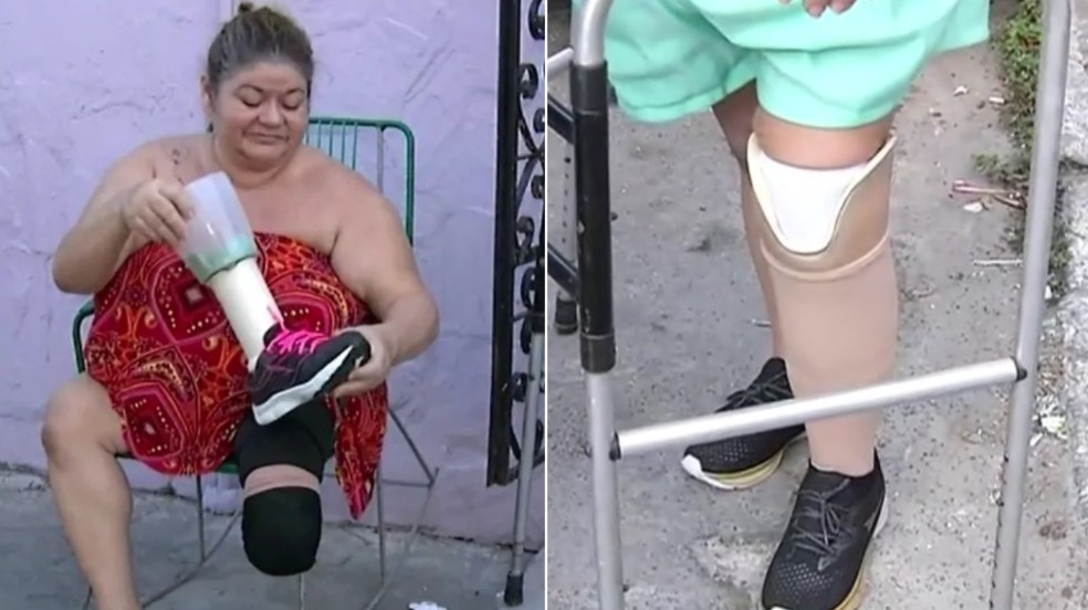 Ana Paula Rodrigues, de 47 anos, usa a prótese há uma semana. Ela conta o prazer de fazer sua comida e ir ao banheiro. — Foto: Reprodução/TV Verdes Mares