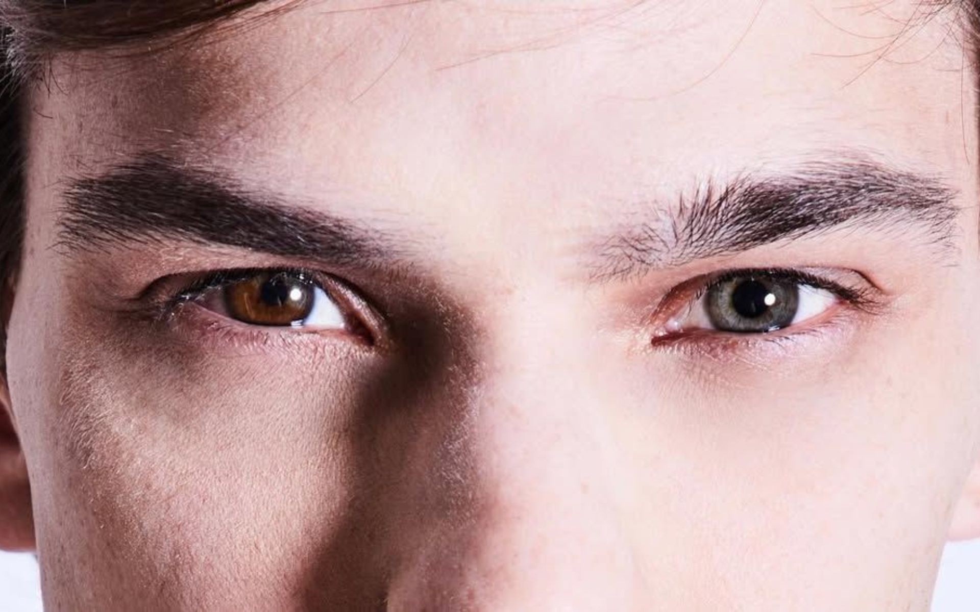 Olhos de cores diferentes: pessoas com heterocromia revelam como encaram condição rara  
