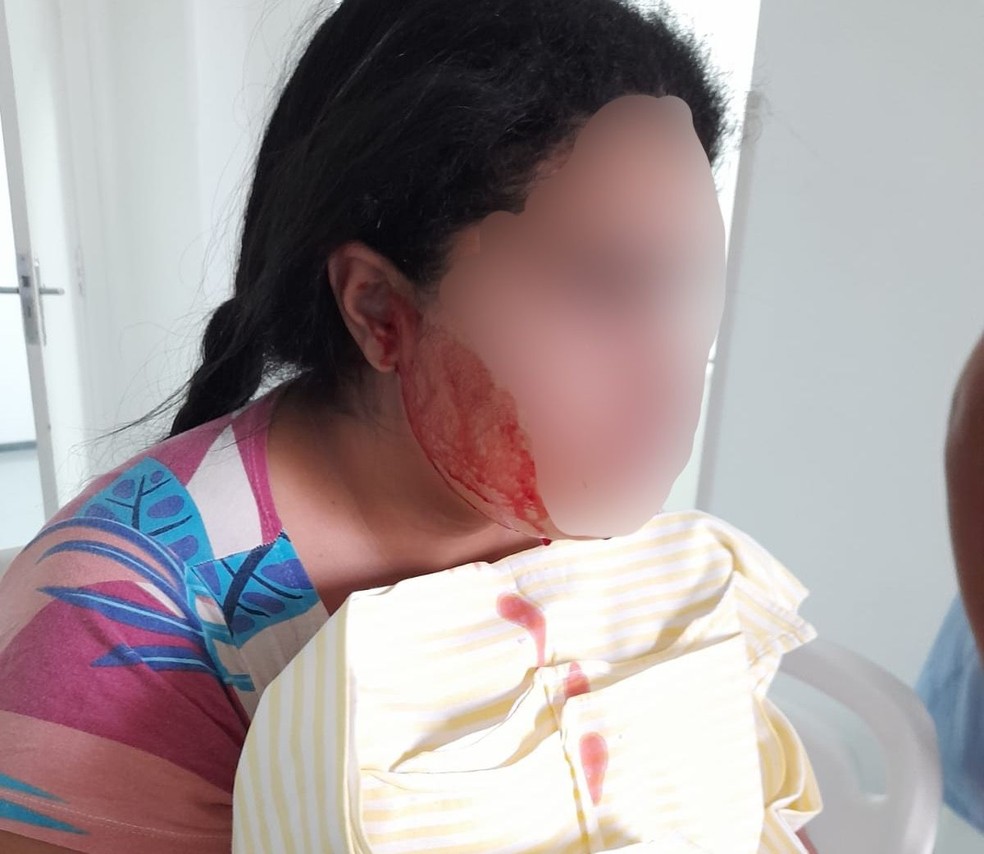 Jovem com sangramentos no nariz, boca e ouvidos foi internada trs vezes na Santa Casa de Santos (SP) apenas neste ano  Foto: Arquivo pessoal