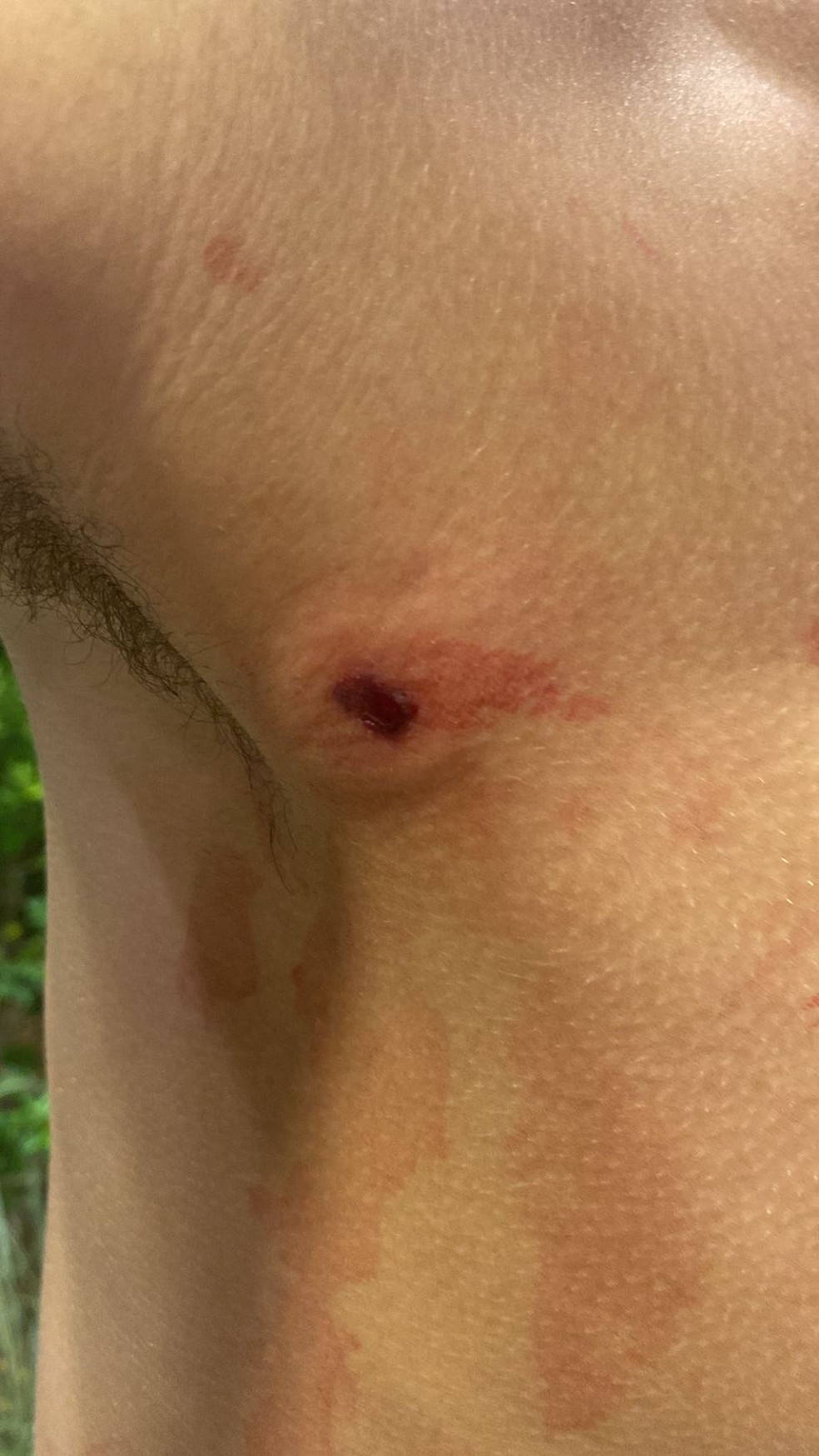Tiro de chumbinho atingiu adolescente de 16 anos na Barra da Tijuca — Foto: Reprodução