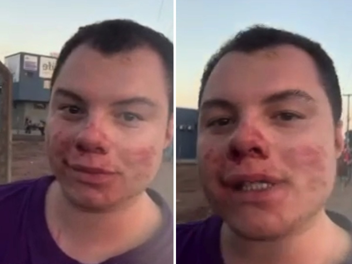 Mãe de influenciador agredido em festa universitária cobra justiça: 'E se eu perco meu filho?'