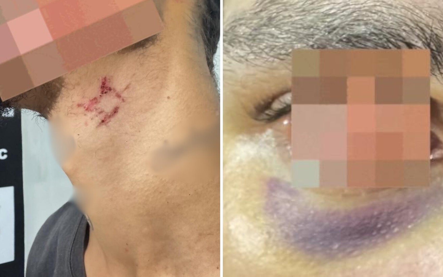 Jovem é achado desnutrido e ferido após mais de um ano em cárcere para ser estuprado por traficante internacional, diz polícia