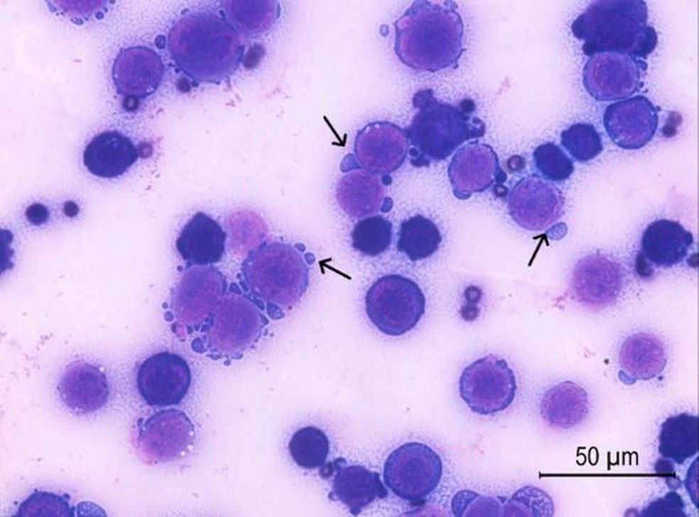 Células tumorais de camundongos que receberam tratamento com a dose de 0,9 micrograma de crotoxina; as setas indicam o processo de morte celular — Foto: Camila Lima Neves/Instituto Butantan