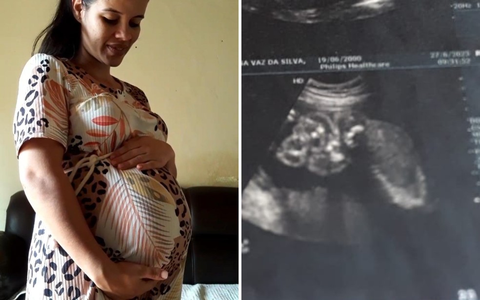 Após vasectomia, casal se surpreende com gravidez de gêmeos em