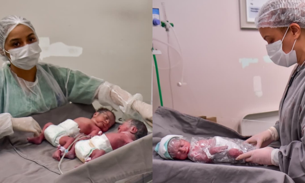 Parto raro de trigêmeos é realizado em maternidade de Manaus