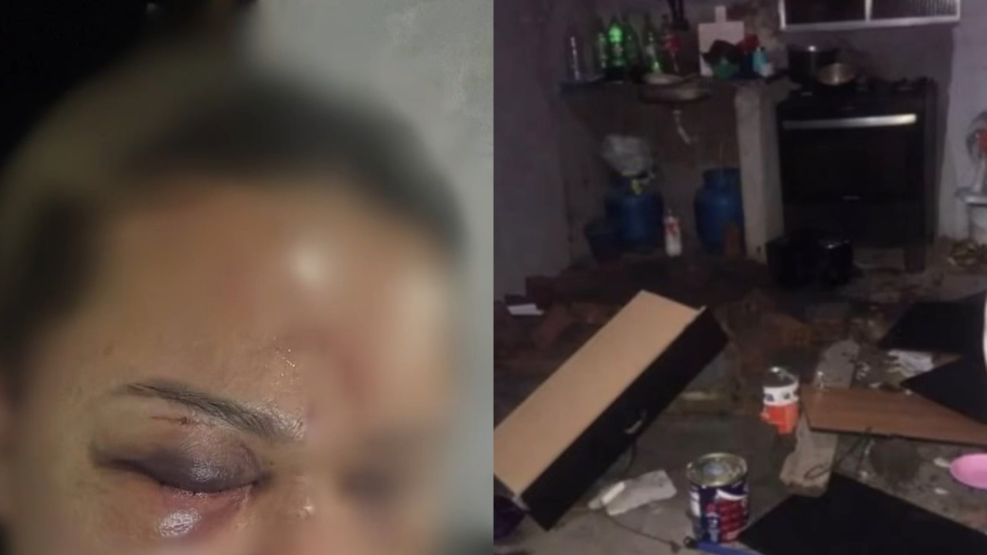 Mulher é agredida pelo companheiro após discussão em São José de Ribamar; suspeito não foi preso