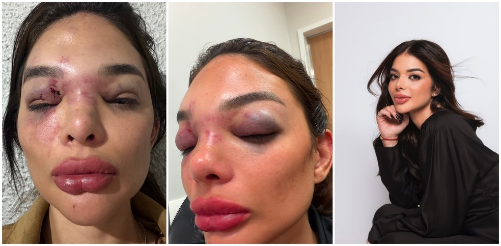 Giulia Melo Falc&atilde;o Vel Kos, de 27 anos, relatou agress&otilde;es de marido &mdash; Foto: Arquivo Pessoal