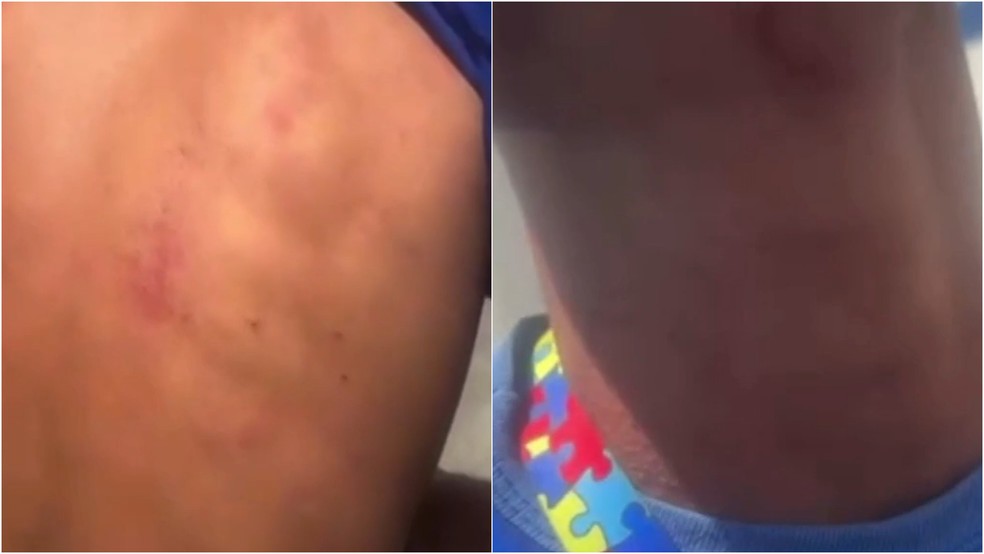 Policiais militares foram afastados para apuração de caso de agressão contra autista no RN — Foto: Reprodução