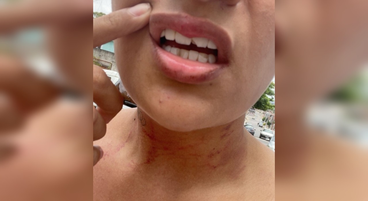 Homem é preso suspeito de invadir loja, agredir e tentar estuprar proprietária; vítima desmaiou duas vezes