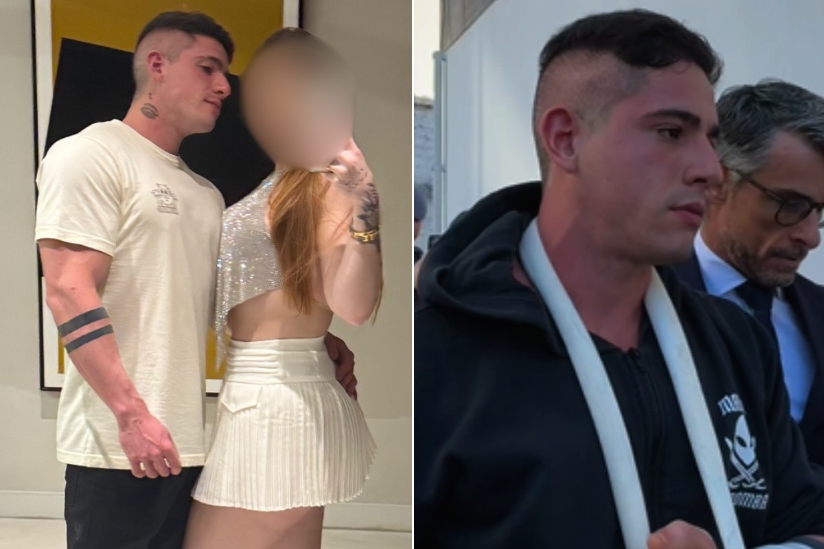 MP denuncia fisiculturista que espancou e quebrou ossos do rosto de namorada médica, diz advogada