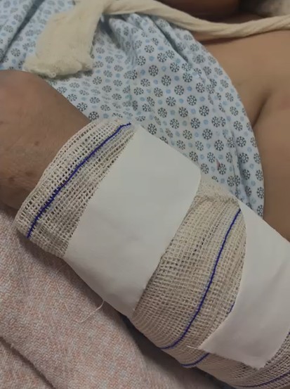 Mulher que foi agredida com barra de ferro por ex-companheiro em BH recebe alta de hospital 