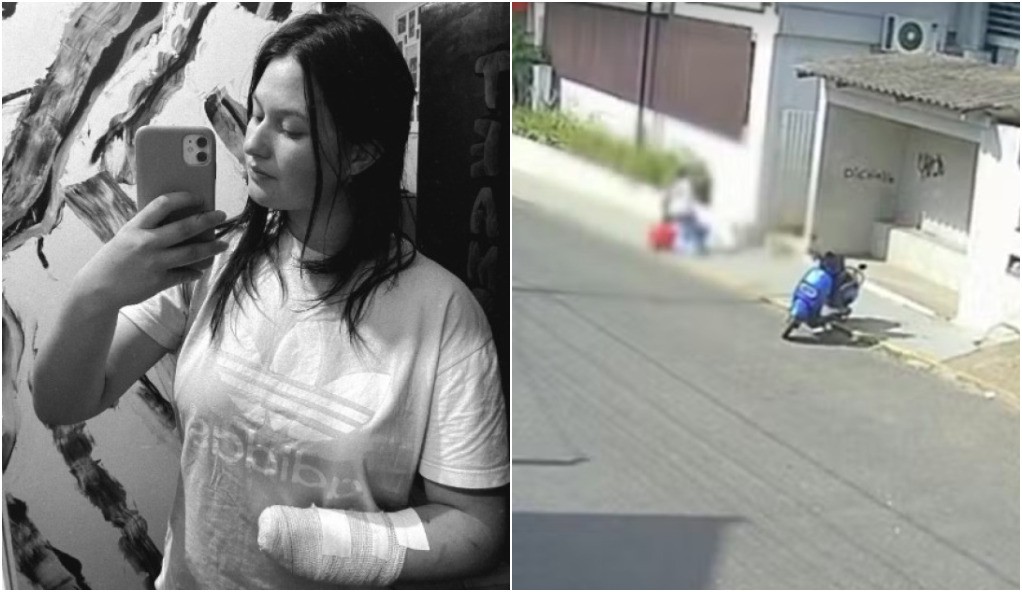 Jovem que teve mão amputada pelo ex com facão em SC desabafa: 'Tento ser forte todos os dias'