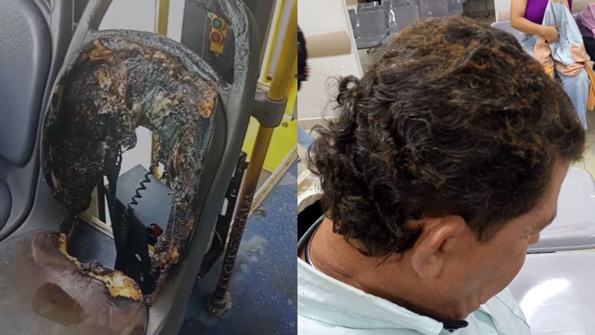 Ônibus é incendiado por criminosos e motorista sofre queimaduras em Olinda; VÍDEO