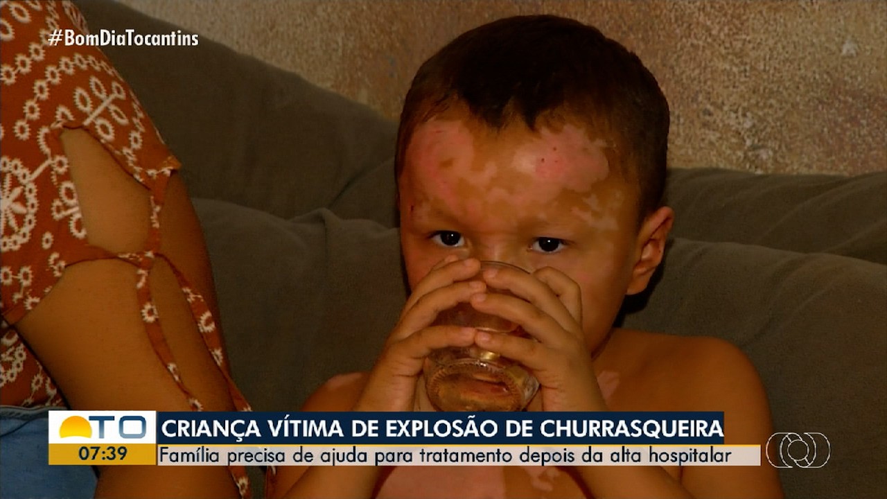 VÍDEOS: Bom Dia Tocantins de segunda-feira, 11 de agosto de 2025