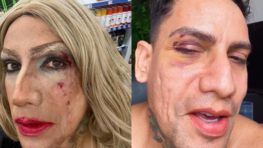 Arquiteto é agredido no carnaval de Olinda e denuncia homofobia - Foto: (Reprodução/WhatsApp)