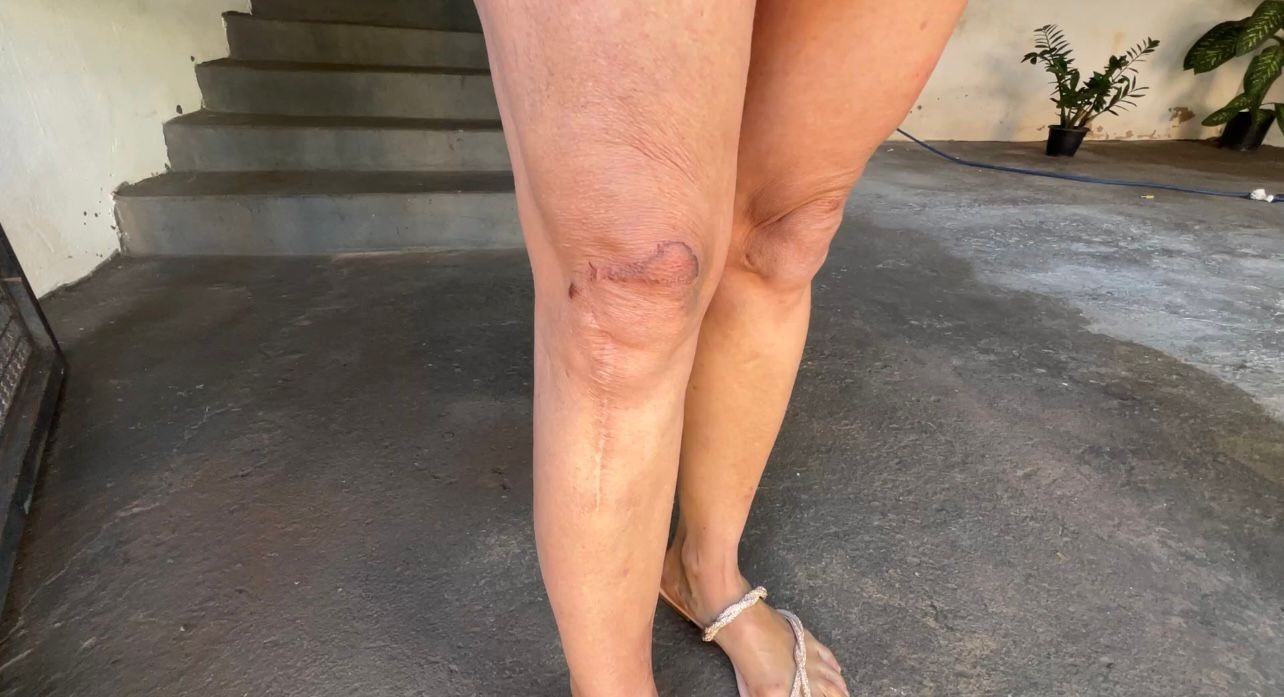 Justiça libera em audiência de custódia homem com passagens criminais suspeito de agredir e arrastar a namorada pelos cabelos 
