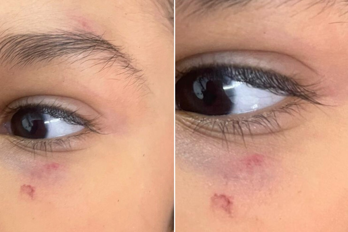 Mãe denuncia professora por jogar pá de lixo no rosto de criança em escola no litoral de SP