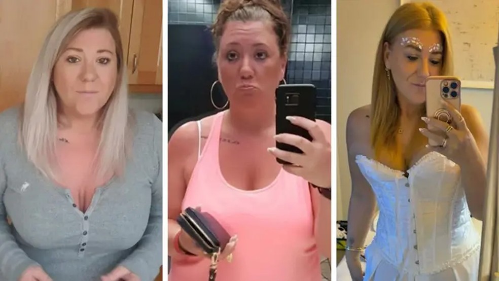 Tanya diz que seu cabelo "caiu em tufos" quando começou a tomar o medicamento — Foto: Tanya Hall via BBC