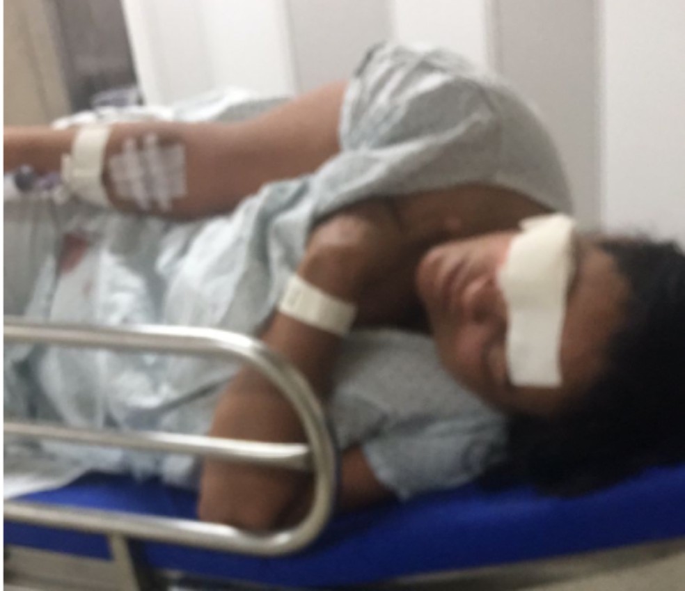 Mulher que teve pedaço do rosto arrancado pelo companheiro na BA recebe alta e diz que já registrou mais de 30 queixas contra suspeito | G1