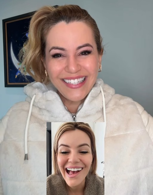 Musa do Carnaval de SP revela que teve nervo facial afetado após retirada de tumor na tireoide