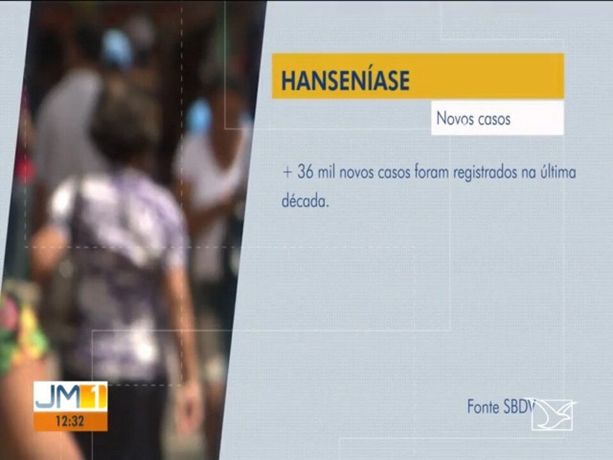 Hanseníase - SBD