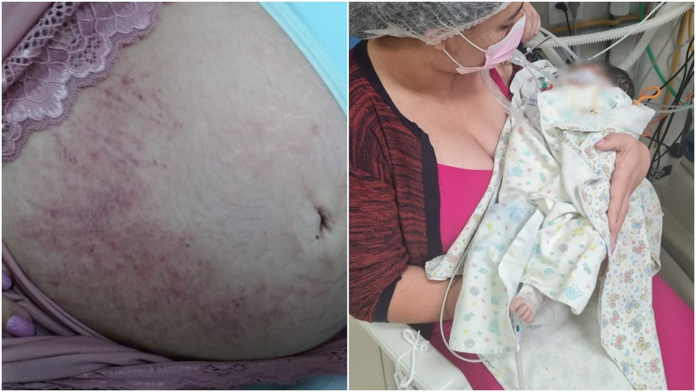 Vanessa Rocha afirma que médico fez a Manobra de Kristeller durante o parto e o bebê dela morreu 17 dias depois. — Foto: Arquivo pessoal