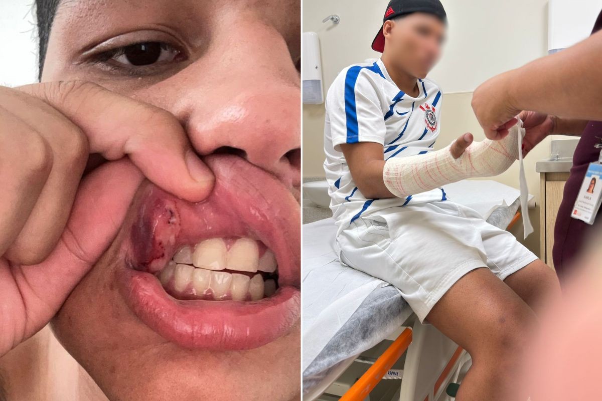 Irmãos tentam se abrigar da chuva e são espancados por segurança do McDonald's no litoral de SP