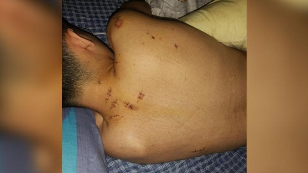Adolescente de 16 anos é esfaqueado 15 vezes enquanto dormia durante assalto a casa, em Fortaleza. — Foto: Arquivo pessoal