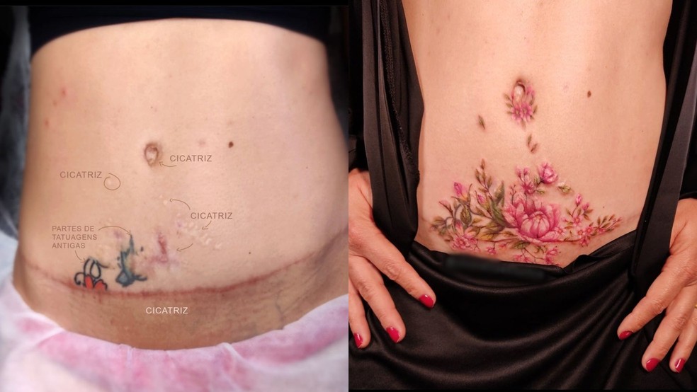 Tatuagem ajuda clientes a recuperaram autoestima diante de marcas no corpo no interior de SP — Foto: Cintia Cavalcanti/Arquivo Pessoal