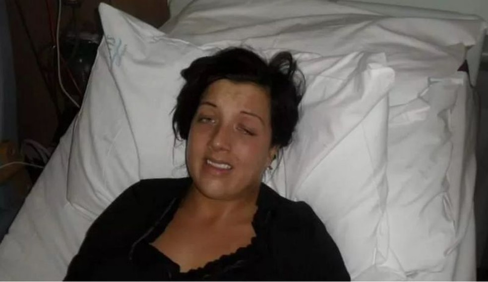 Leann passou meses no hospital aps uma cirurgia mal-sucedida — Foto: BBC