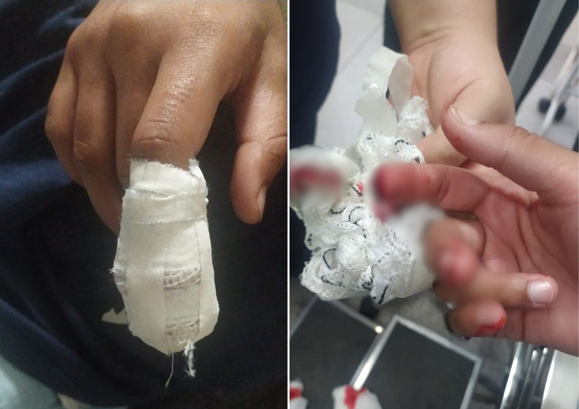 Menina tem o dedo decepado após mão ficar prensada em porta em escola estadual