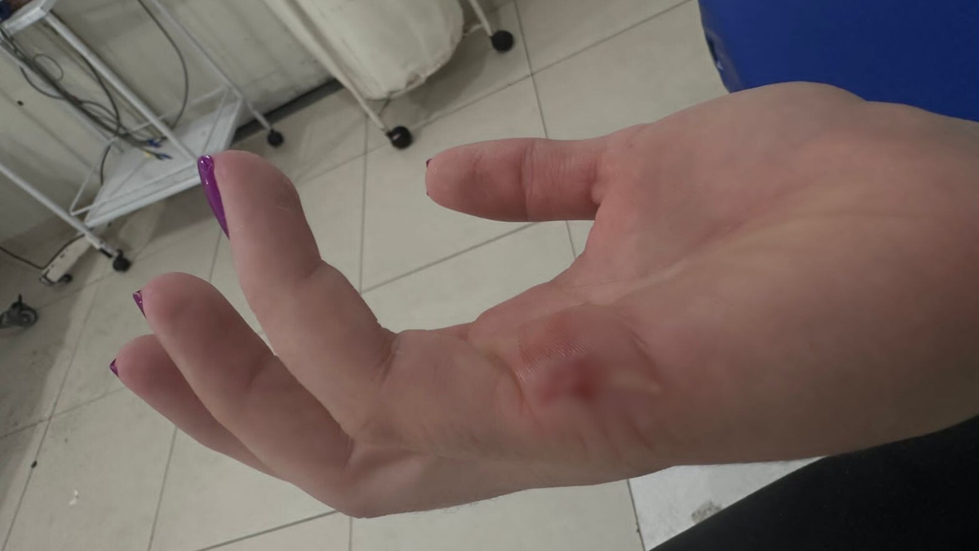 Responsável por enfermeira e técnica de enfermagem diz que funcionárias foram agredidas pela 2ª vez em UPA de Jales: 'Agressão foi gratuita'
