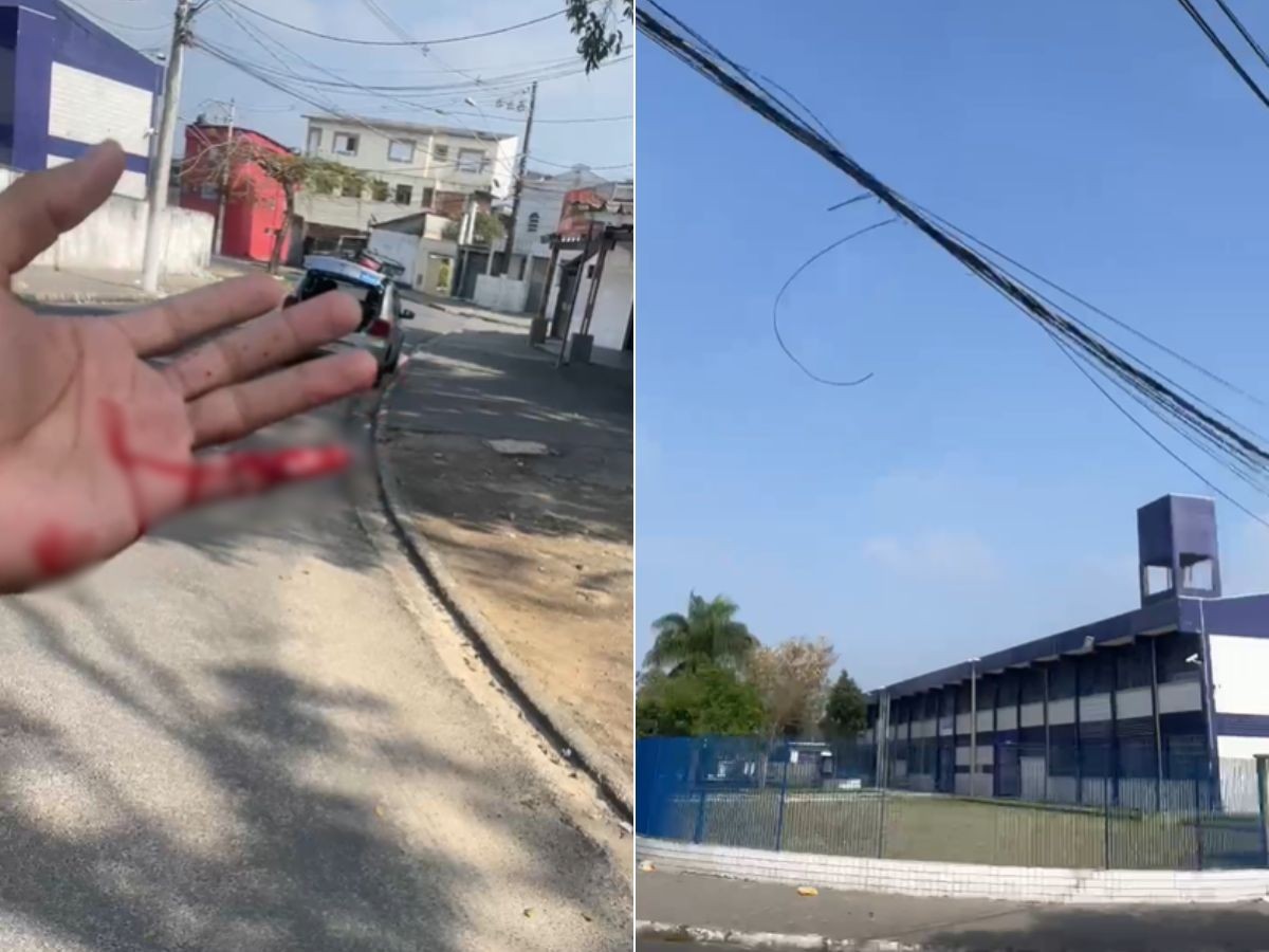 Motociclista perde parte do dedo após ficar com a mão presa em um fiação solta na rua; VÍDEO
