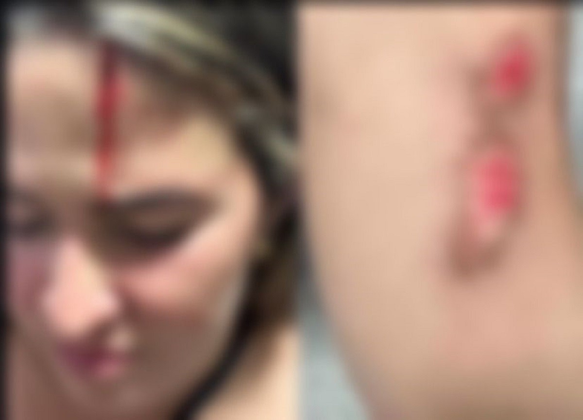 Tentativa de feminicídio: mulher é atropelada e agredida pelo ex em Alagoas