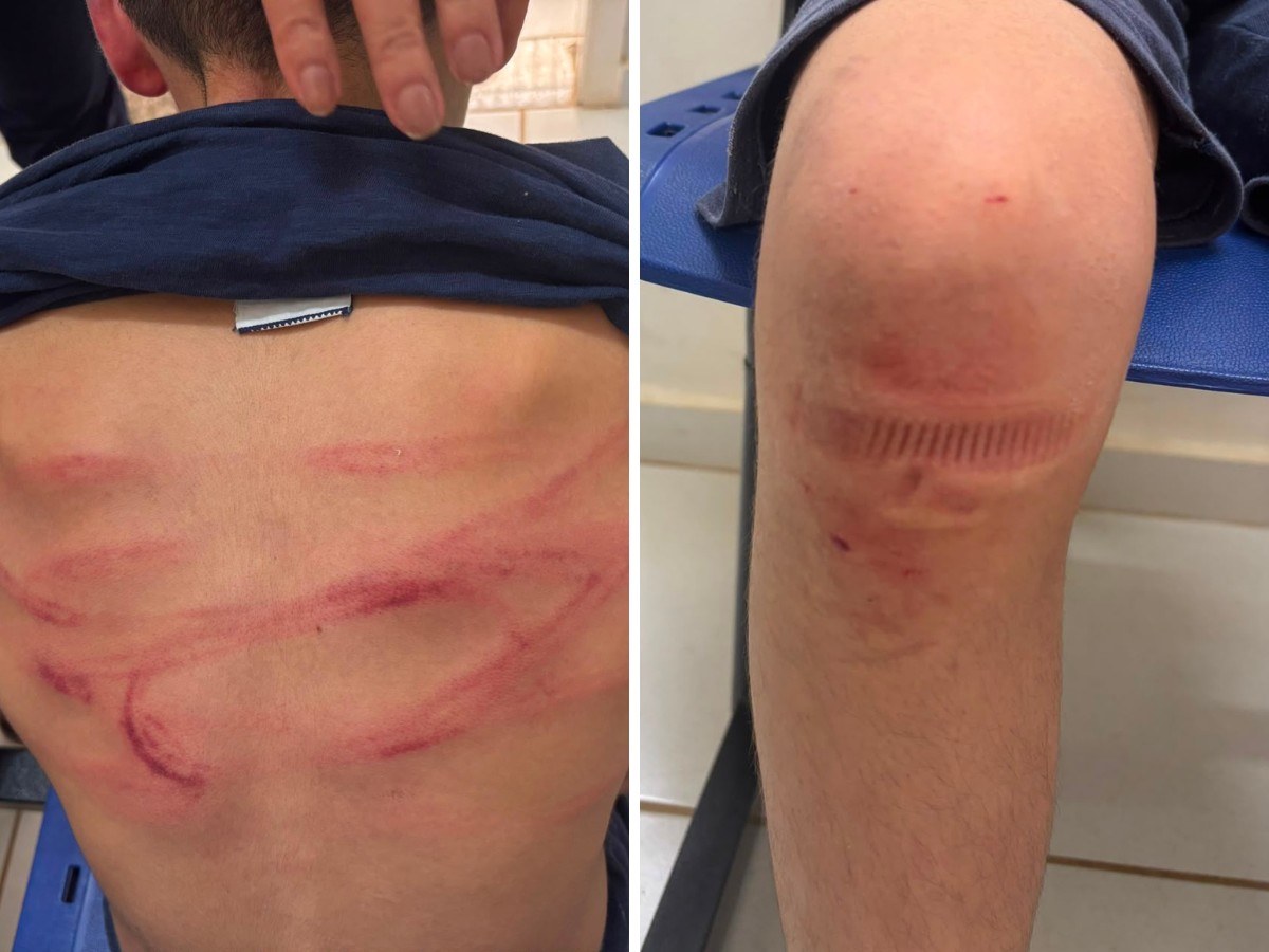 Mangueira, cabo de marreta e peças metálicas: homem é preso após torturar enteado de 12 anos em Artur Nogueira