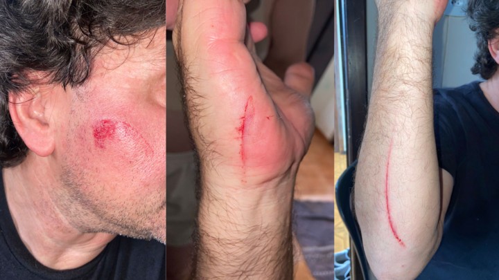 Motorista de aplicativo é atacado com facão por passageiro durante corrida em Toledo