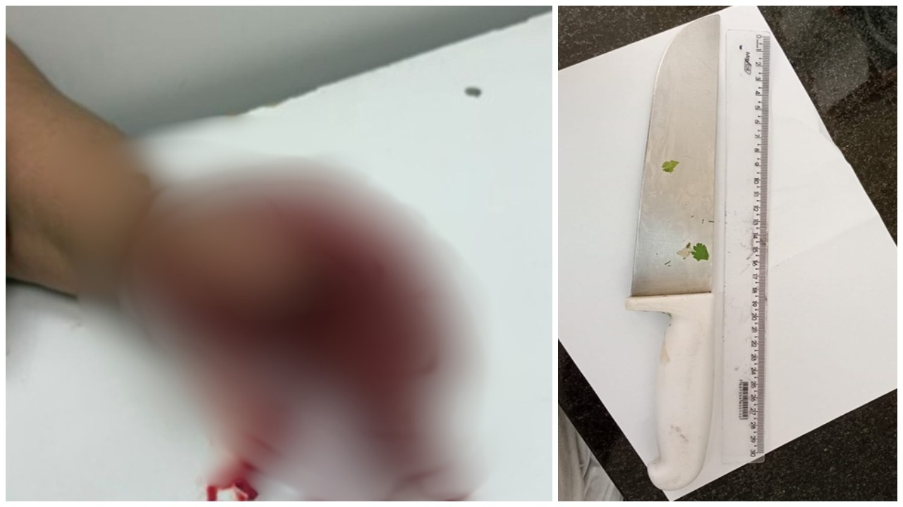 Justiça solta homem que decepou o dedo da esposa com faca de açougueiro em Taboão da Serra