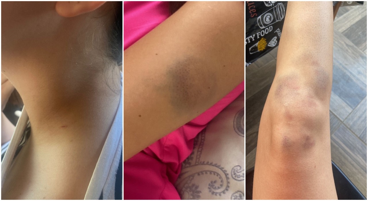 Polícia cumpre mandado de busca e apreensão na casa de Thiago Schutz, acusado de agressão contra namorada