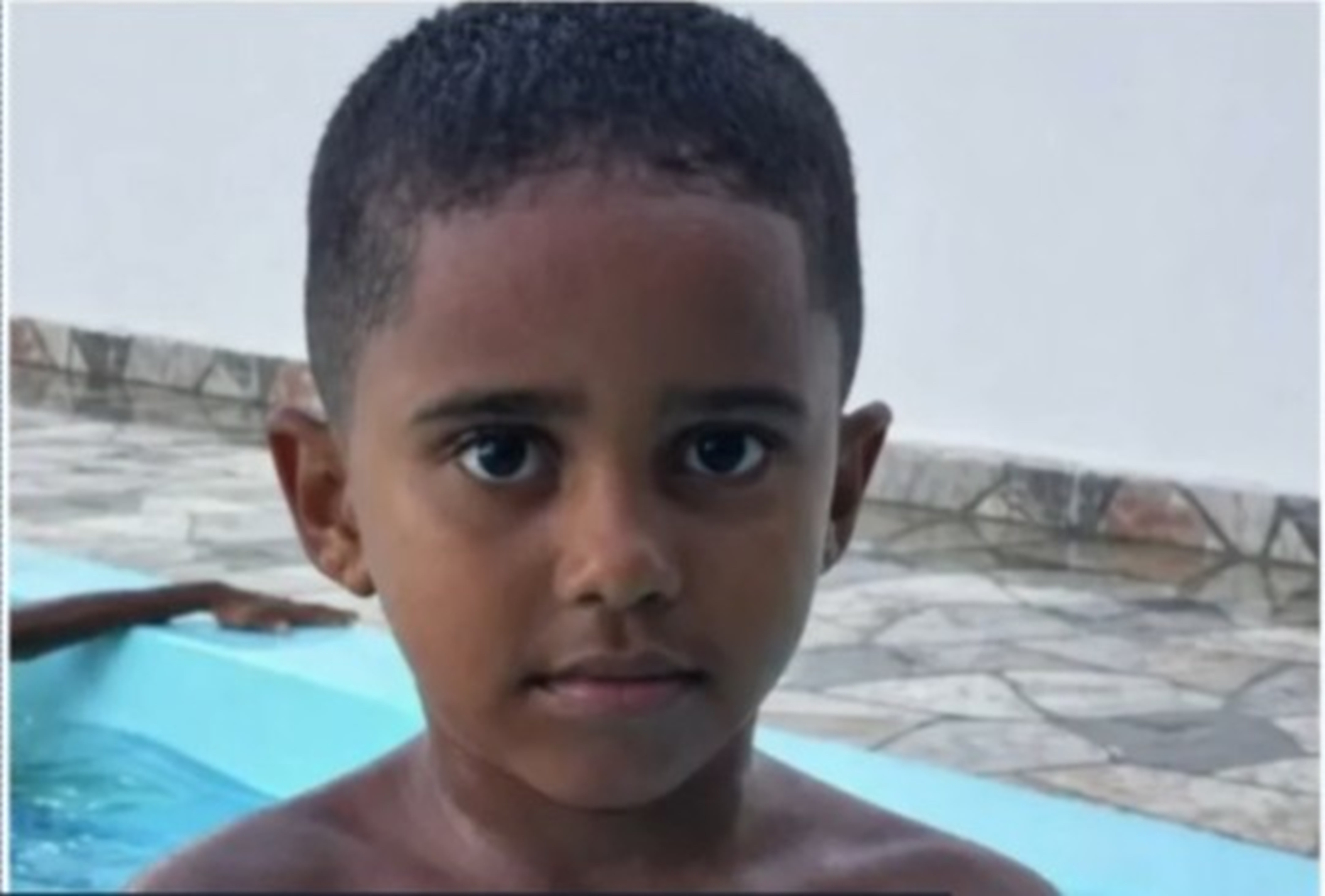 Menino de 5 anos morre vítima de choque elétrico em Araçoiaba, no Grande Recife