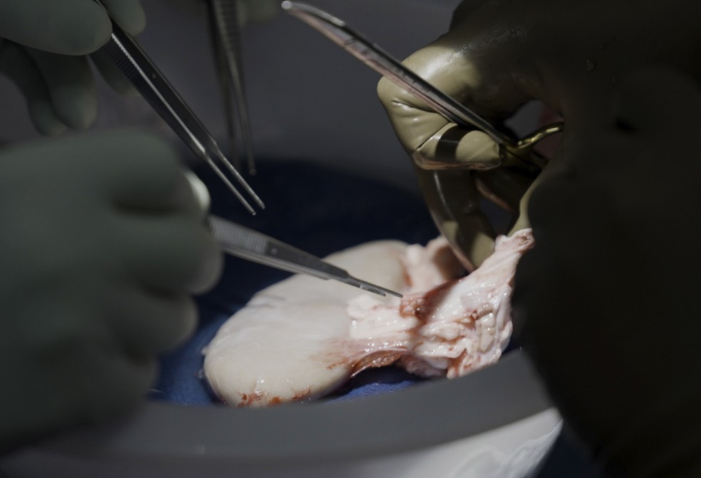 Cirurgiões do Langone Health Medical Center da Universidade de NY se preparando para transplantar o rim de um porco em um homem com morte cerebral em 14/07/2023 — Foto: AP Photo/Shelby Lum