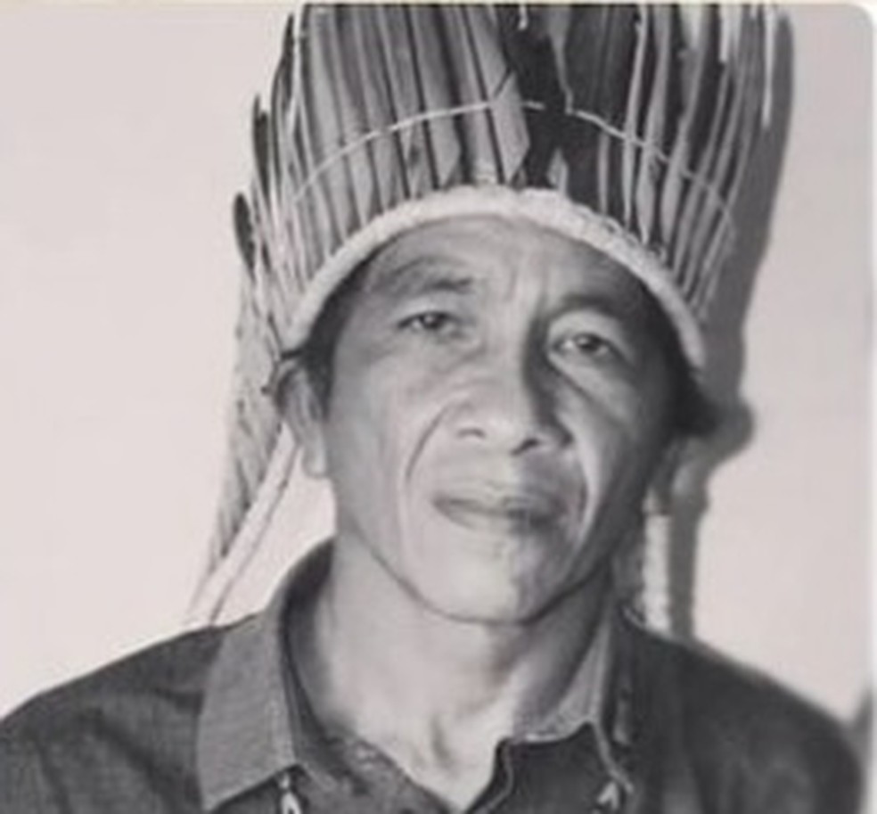 Cacique Tembé foi baleado durante atentado e está internado no Pará  — Foto: Fepipa/Reprodução 