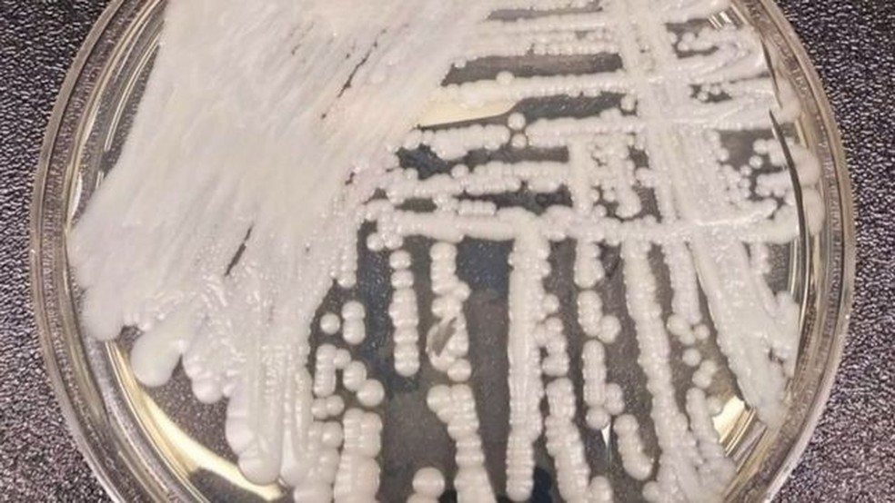 A infecção pelo Candida auris é resistente a medicamentos e pode ser fatal (Arquivo) — Foto: Reuters