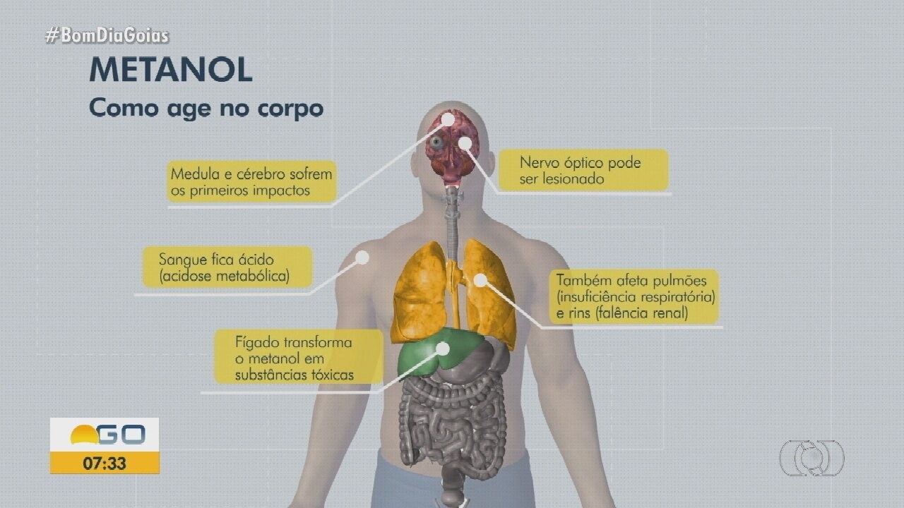 Paciente com intoxicação por metanol morre em MT | G1