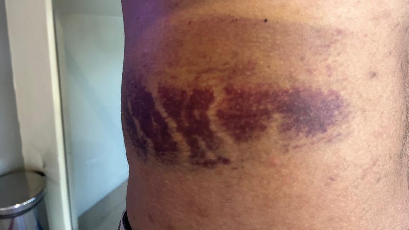 Confusão entre dois homens em hospital termina com agressões em Paracuru, no Ceará