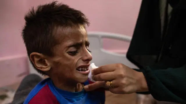 Gaza enfrenta 'pior cenário possível de fome', diz órgão de segurança alimentar ligado à ONU