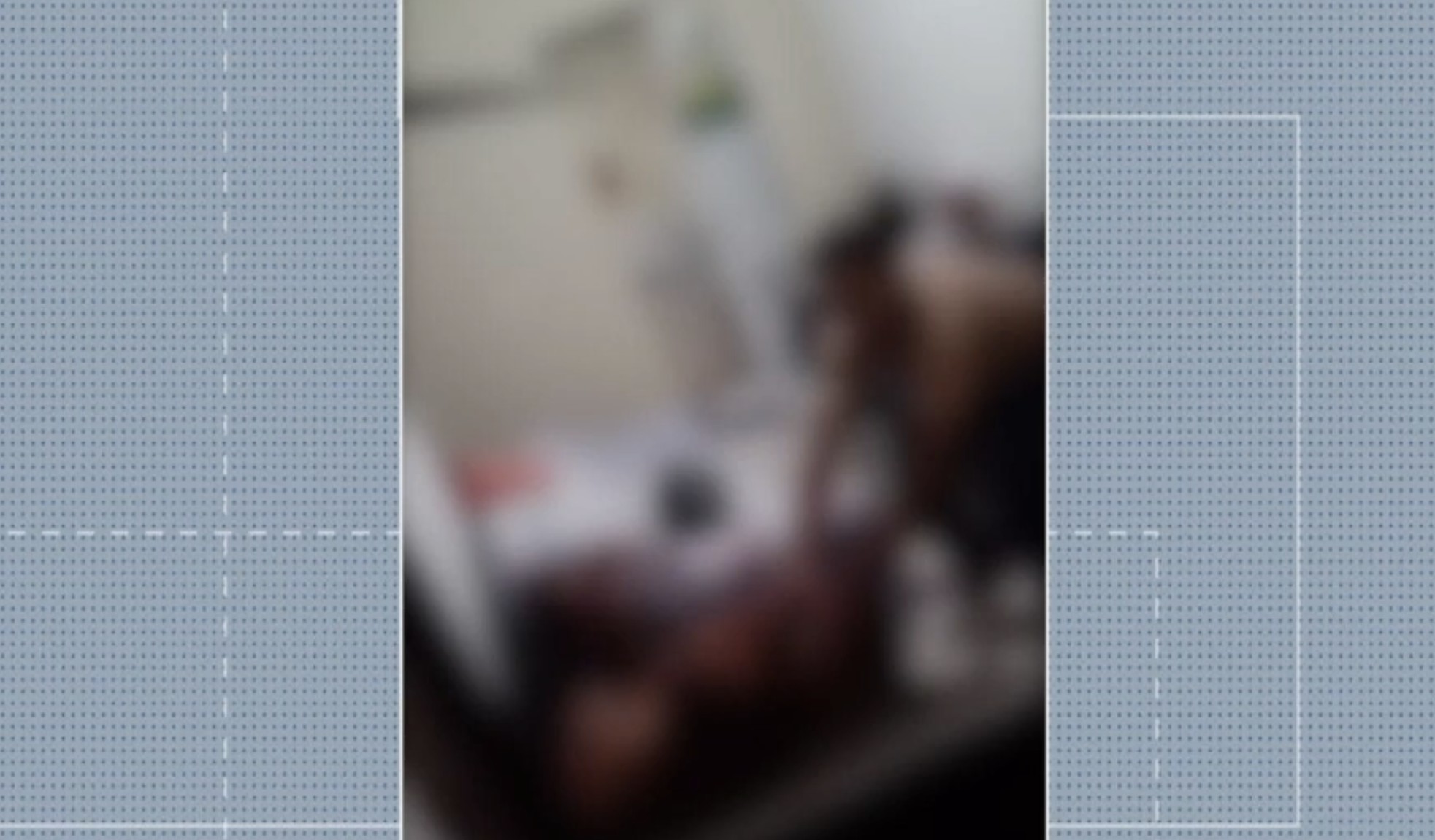 Mulher que teve dedo e orelha decepados por ex-companheiro passa por cirurgia em Natal