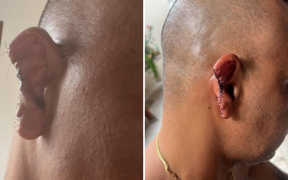 Policial que teve parte de orelha arrancada diz que só notou mordida após colega avisar - Goiás — Foto: Arquivo pessoal/ Sérgio Junior